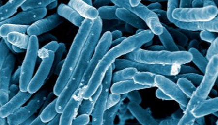 Un compuesto natural disminuye la capacidad infectiva de las bacterias