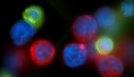 Crean virus que podrían atacar de forma selectiva a las células tumorales