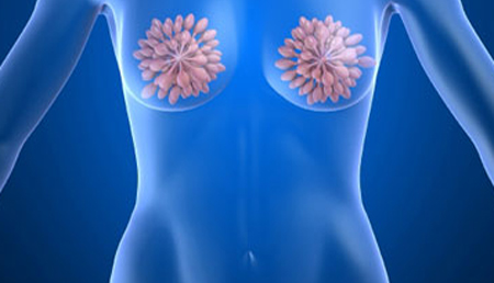 Un subtipo de cáncer de mama triple negativo, más susceptible  a la inmunoterapia