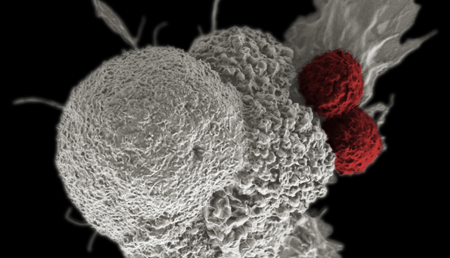 La gran capacidad proliferativa de las células cancerígenas puede ser su perdición
