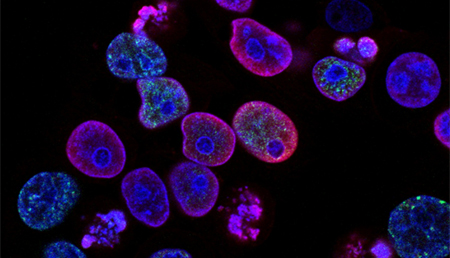 El “copiapega” molecular da un nuevo paso para evitar los procesos de alteración epigenética del cáncer
