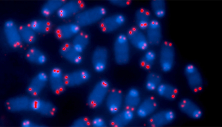 Los tumores con alteraciones cromosómicas más graves son más resistentes a los ataques del sistema inmunitario
