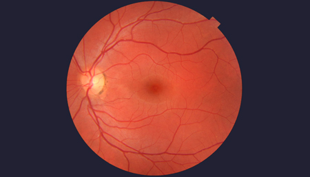 Una terapia celular mejora la visión en ratones con degeneración retiniana