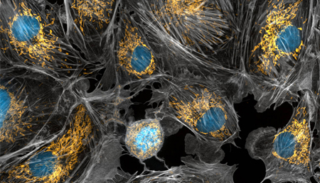 Nuevos mecanismos implicados en la función y dinámica de las mitocondrias