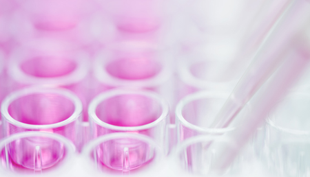Un test genómico para evitar tratamientos de quimioterapia innecesarios en cáncer mama