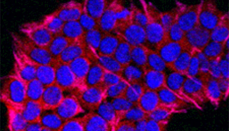 Una nueva investigación enfatiza el potencial de una prometedora diana para el cáncer pancreático 