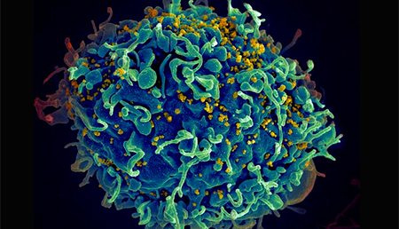 Eliminar el VIH de células vivas podría ser posible mediante una técnica de edición genética