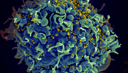 La edición genética también abre nuevas esperanzas en el tratamiento del VIH
